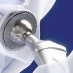 csm_Medizintechnik-kuehlschmierstoffe-knieprothese-titan-nickel-oemeta_21d9c9b835